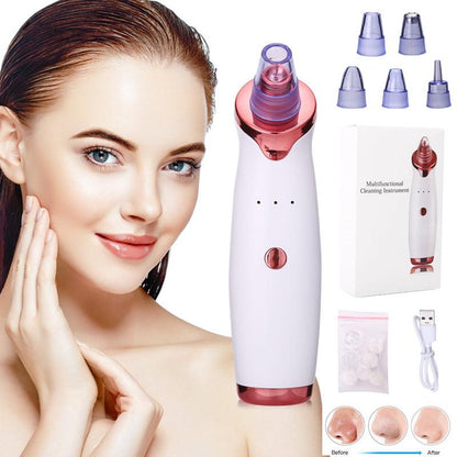 Blackhead Remover Vacuum with 3-Level Suction Power for Acne &amp; Pore Cleansing - Luminessbty